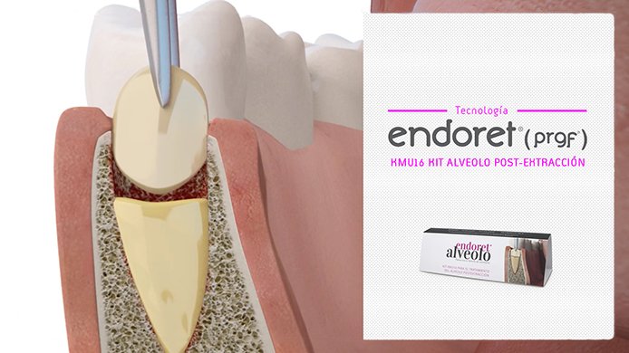 endoret